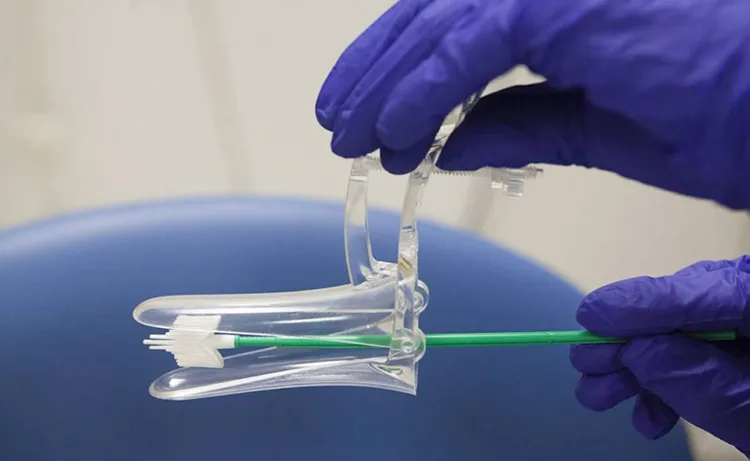 Smear (Rahim Ağzı Kanser Tarama Testi)