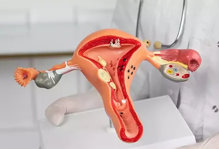 Rahim Duvarı Kalınlaşması Nedir? Nedenleri, Belirtileri ve Tedavi Yöntemleri