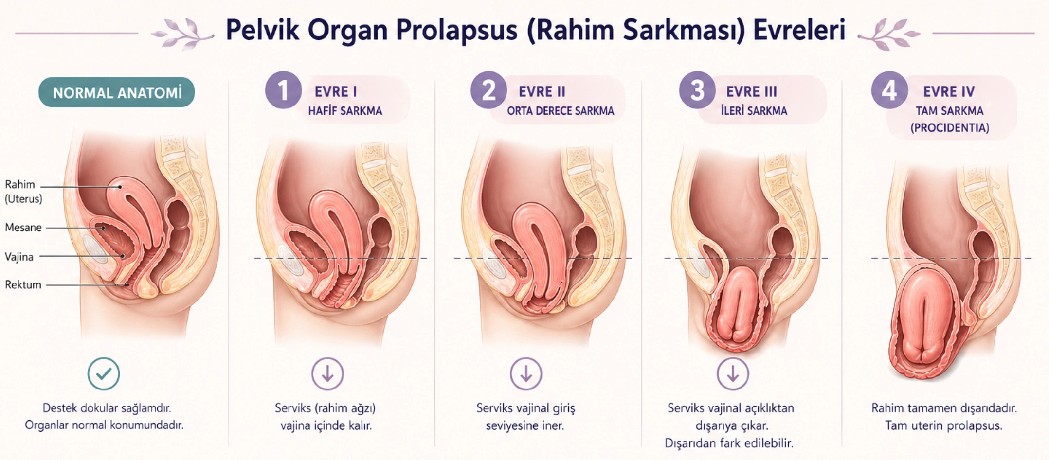 Rahim Sarkması